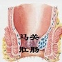 云南省马关肛肠微信公众号